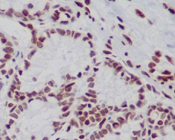 m12477 8 ihc