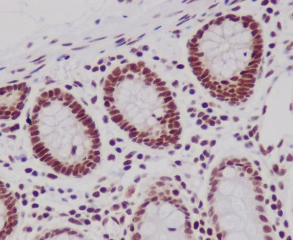 m12477 ihc