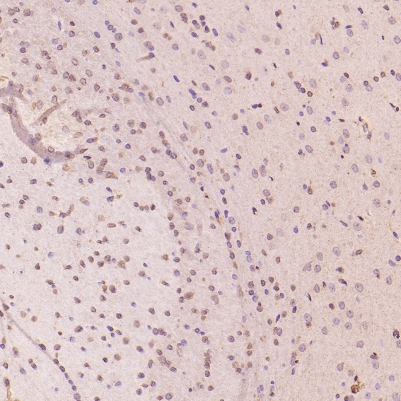 m12477 ihc7