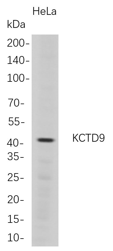 Western Blot analysis of HeLa whole cell lysates were separated by 4-20% SDS-PAGE, and the membrane was blotted with anti-KCTD9 rabbit mAb