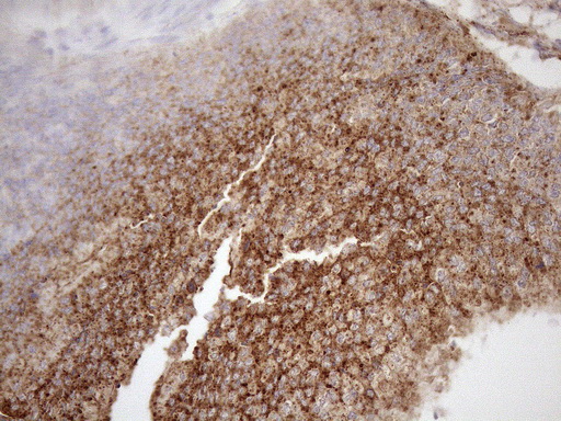 m12515 anti kctd9 mouse monoclonal antibody clone id oti2g8 ihc testing 10