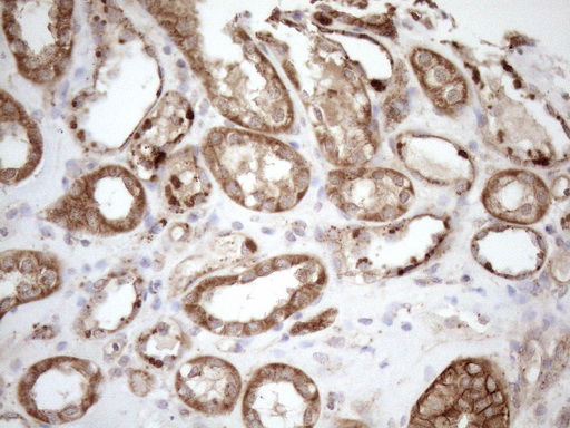 m12515 anti kctd9 mouse monoclonal antibody clone id oti2g8 ihc testing 11