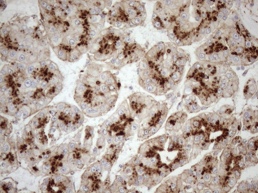 m12515 anti kctd9 mouse monoclonal antibody clone id oti2g8 ihc testing 12