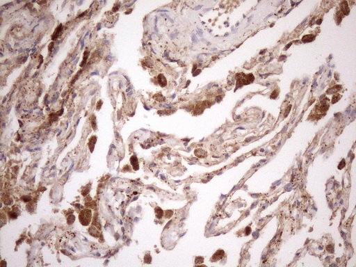 m12515 anti kctd9 mouse monoclonal antibody clone id oti2g8 ihc testing 13