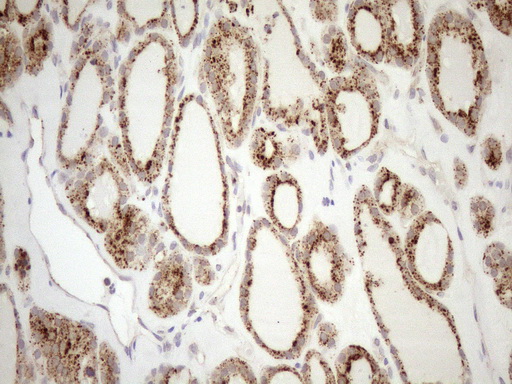 m12515 anti kctd9 mouse monoclonal antibody clone id oti2g8 ihc testing 4