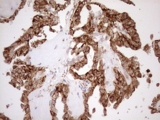m12515 anti kctd9 mouse monoclonal antibody clone id oti2g8 ihc testing 5