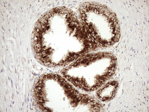 m12515 anti kctd9 mouse monoclonal antibody clone id oti2g8 ihc testing 7