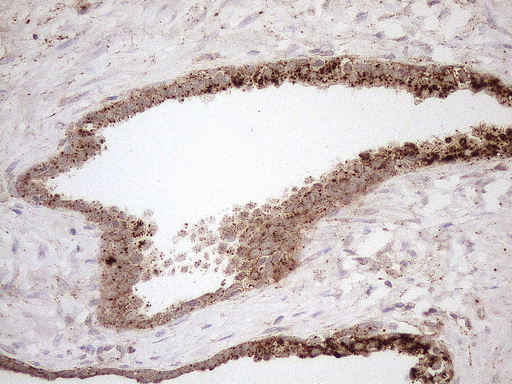 m12515 anti kctd9 mouse monoclonal antibody clone id oti2g8 ihc testing 8