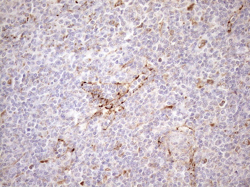 m12515 anti kctd9 mouse monoclonal antibody clone id oti2g8 ihc testing 9