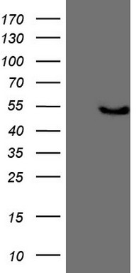HEK293T cells were transfected with the pCMV6-ENTRY control (Left lane) or pCMV6-ENTRY KCTD9 (Right lane) cDNA for 48 hrs and lysed