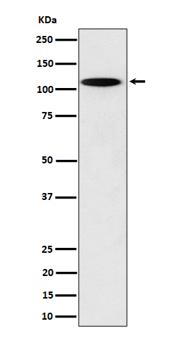 Western blot analysis of N4BP1 expression in PC12 cell lysate