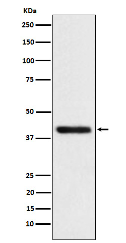 Western blot analysis of TMOD2 expression in SH-SY5Y cell lysate