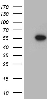 HEK293T cells were transfected with the pCMV6-ENTRY control (Left lane) or pCMV6-ENTRY FOXN2 (Right lane) cDNA for 48 hrs and lysed