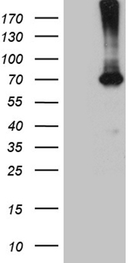 HEK293T cells were transfected with the pCMV6-ENTRY control (Left lane) or pCMV6-ENTRY PGM2L1 (Right lane) cDNA for 48 hrs and lysed