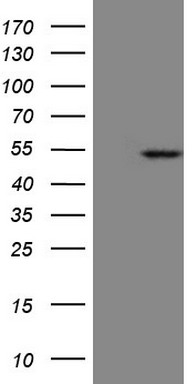 m12673 anti krt23 mouse monoclonal antibody clone id oti3f2 wb testing 1