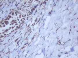 m12681 anti ddx59 mouse monoclonal antibody clone id oti2g1 ihc testing 10