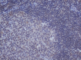 m12681 anti ddx59 mouse monoclonal antibody clone id oti2g1 ihc testing 11