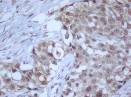 m12681 anti ddx59 mouse monoclonal antibody clone id oti2g1 ihc testing 13