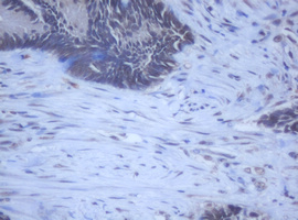m12681 anti ddx59 mouse monoclonal antibody clone id oti2g1 ihc testing 14