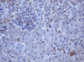m12681 anti ddx59 mouse monoclonal antibody clone id oti2g1 ihc testing 15