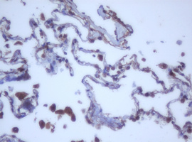 m12681 anti ddx59 mouse monoclonal antibody clone id oti2g1 ihc testing 16