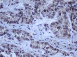 m12681 anti ddx59 mouse monoclonal antibody clone id oti2g1 ihc testing 2