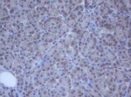 m12681 anti ddx59 mouse monoclonal antibody clone id oti2g1 ihc testing 3