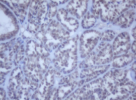 m12681 anti ddx59 mouse monoclonal antibody clone id oti2g1 ihc testing 4