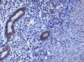m12681 anti ddx59 mouse monoclonal antibody clone id oti2g1 ihc testing 5