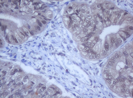 m12681 anti ddx59 mouse monoclonal antibody clone id oti2g1 ihc testing 6