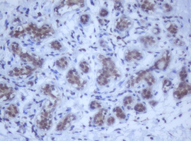m12681 anti ddx59 mouse monoclonal antibody clone id oti2g1 ihc testing 7