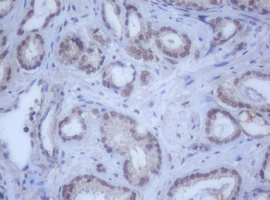 m12681 anti ddx59 mouse monoclonal antibody clone id oti2g1 ihc testing 8