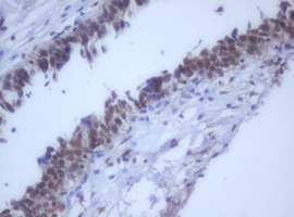 m12681 anti ddx59 mouse monoclonal antibody clone id oti2g1 ihc testing 9