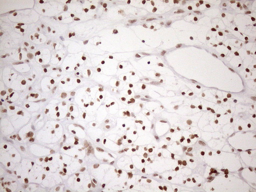 m12685 anti utp11l utp11 mouse monoclonal antibody clone id oti5f3 ihc testing 11