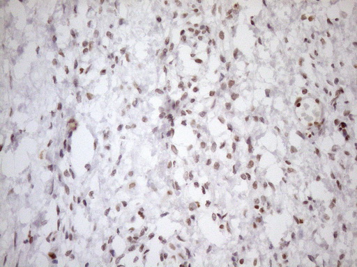Immunohistochemical staining of paraffin-embedded Human Ovary tissue within the normal limits using anti-UTP11L mouse monoclonal antibody. (Heat-induced epitope retrieval by 1mM EDTA in 10mM Tris buffer (pH8.5) at 120°C for 3min