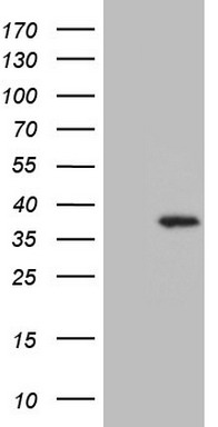 HEK293T cells were transfected with the pCMV6-ENTRY control (Left lane) or pCMV6-ENTRY UTP11L (Right lane) cDNA for 48 hrs and lysed. Equivalent amounts of cell lysates (5 ug per lane) were separated by SDS-PAGE and immunoblotted with anti-UTP11L (1:2000).