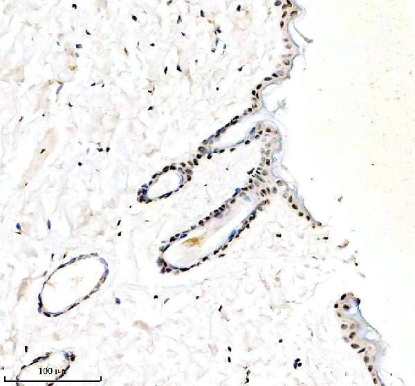 IHC analysis of Galectin-7/LGALS7 using anti-Galectin-7/LGALS7 antibody (M12693-1)