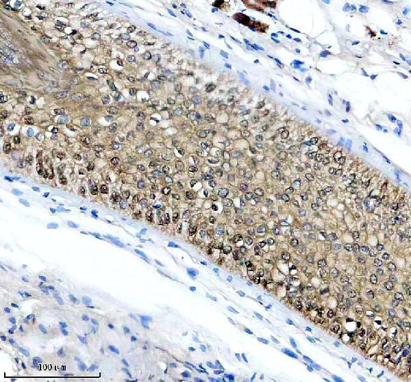 IHC analysis of Galectin-7/LGALS7 using anti-Galectin-7/LGALS7 antibody (M12693-1)