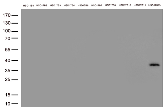 m12700 anti hsd17b13 mouse monoclonal antibody clone id oti5c4 wb testing 2