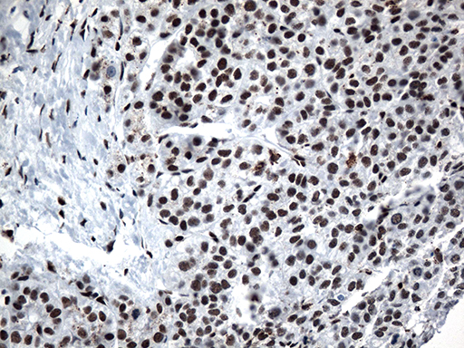 m12724 anti gtf3c4 mouse monoclonal antibody clone id oti4a1 ihc testing 10