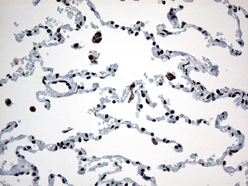 m12724 anti gtf3c4 mouse monoclonal antibody clone id oti4a1 ihc testing 11