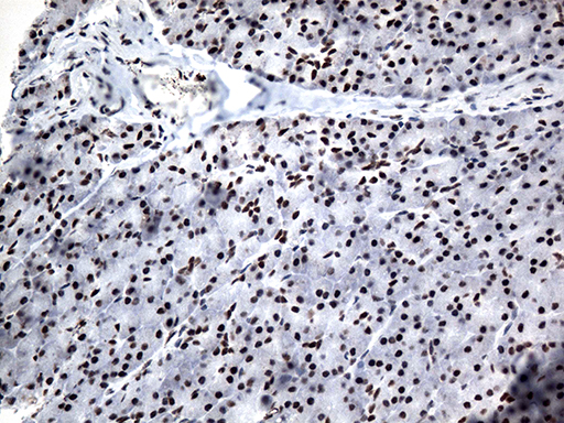m12724 anti gtf3c4 mouse monoclonal antibody clone id oti4a1 ihc testing 5