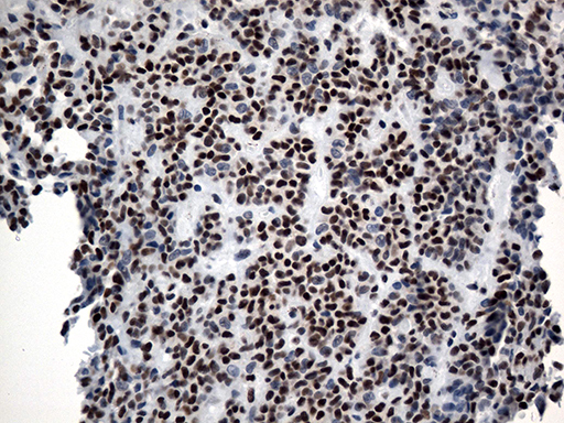 m12724 anti gtf3c4 mouse monoclonal antibody clone id oti4a1 ihc testing 6