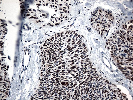 m12724 anti gtf3c4 mouse monoclonal antibody clone id oti4a1 ihc testing 7