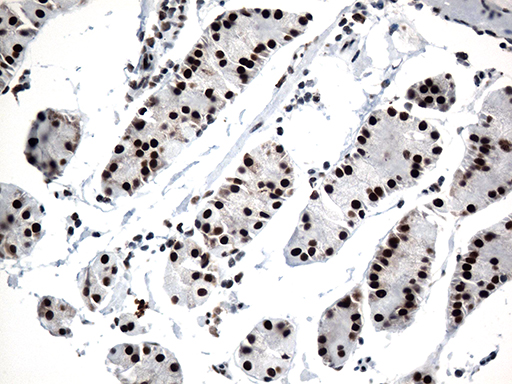 m12724 anti gtf3c4 mouse monoclonal antibody clone id oti4a1 ihc testing 8