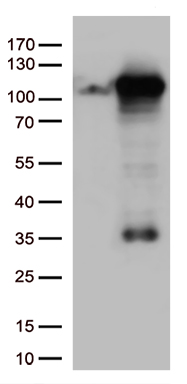 HEK293T cells were transfected with the pCMV6-ENTRY control (Left lane) or pCMV6-ENTRY GTF3C4 (Right lane) cDNA for 48 hrs and lysed