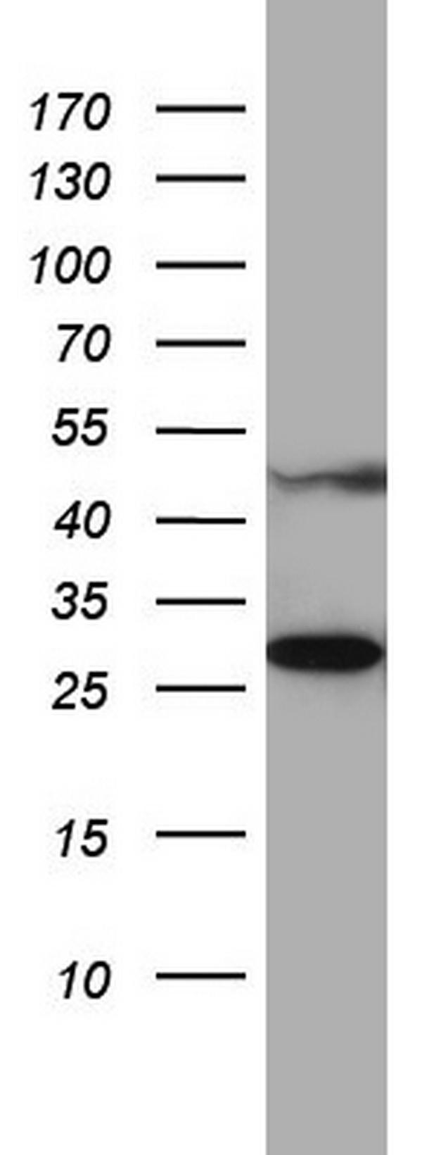 m12749 anti mrps7 mouse monoclonal antibody clone id oti5e11 wb testing 1