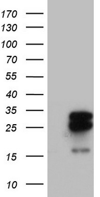 m12749 anti mrps7 mouse monoclonal antibody clone id oti5e11 wb testing 2