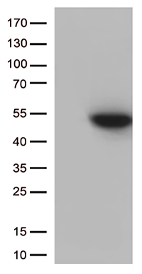 HEK293T cells were transfected with the pCMV6-ENTRY control (Left lane) or pCMV6-ENTRY CDK15 (Right lane) cDNA for 48 hrs and lysed