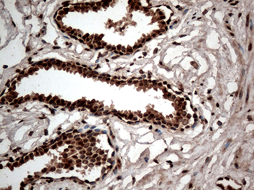 Immunohistochemical staining of paraffin-embedded Human prostate tissue within the normal limits using anti-CDK15 mouse monoclonal antibody